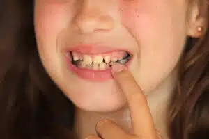 When should my child see an orthodontist?