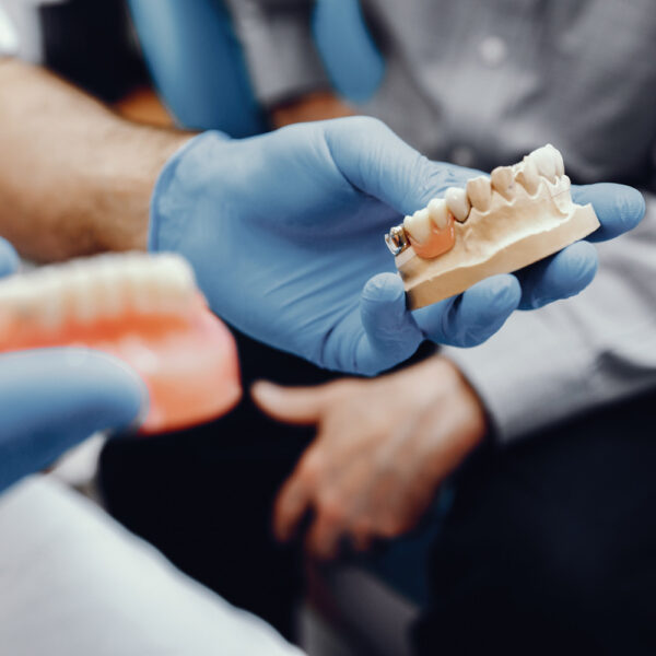 Dental Implants vs. Dentures: Expert Insights to Make Right Choice
