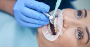 Why Get Sealants for Teeth
