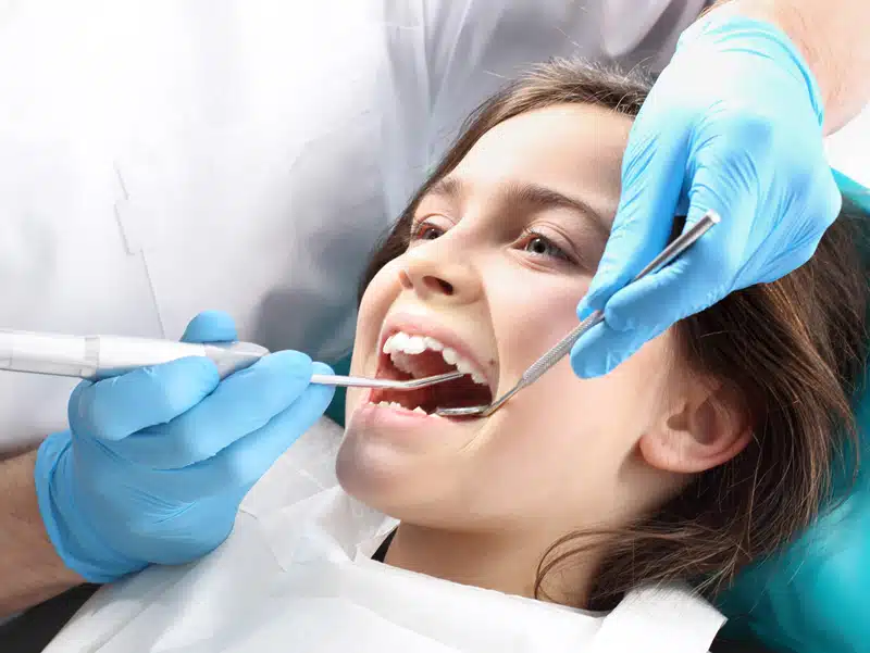 How long dental sealants last for kids